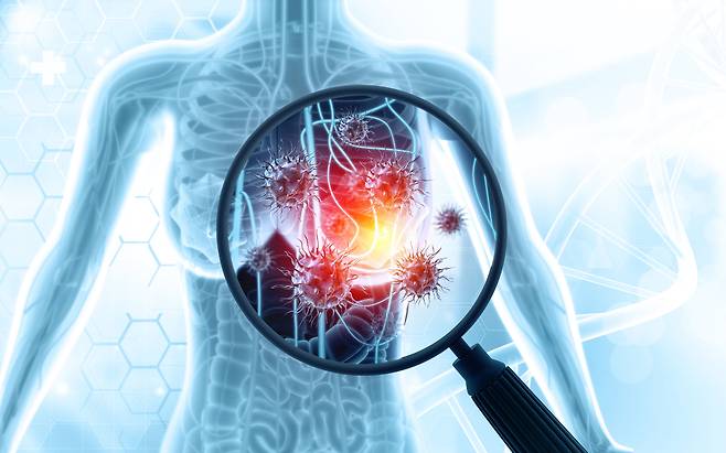 유방암 환자가 매해 꾸준히 늘어나는 가운데, 전문가들은 정기 검진을 통해 조기 발견을 하면 완치율을 크게 높일 수 있다고 조언한다. 게티이미지뱅크&nbsp;