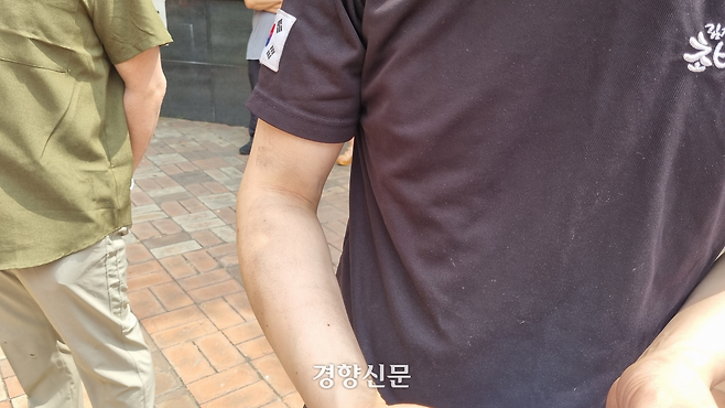 서울 지하철 여의나루역에서 마포역으로 향하는 지하철에서 31일 오전 난 화재의 최초 신고자 중 한 명인 오창근씨(29)의 팔이 검게 그을려 있다. 강한들 기자