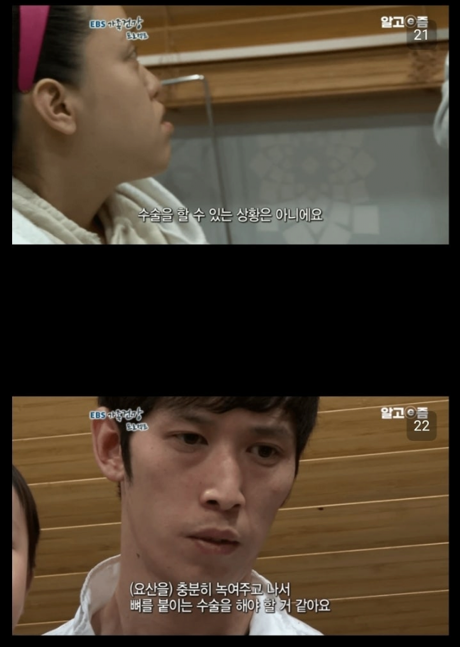 통풍 방치하면 안되는이유
