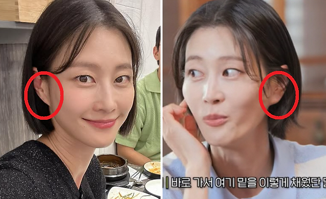 모델 이현이가 귀 필러를 맞기 전(왼쪽)과 맞은 후의 모습. [이현이 SNS·관상학개론 갈무리]