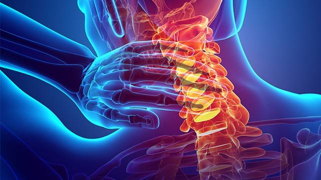 목디스크 재발을 예방하기 위해서는 관리가 무엇보다 중요하다｜출처: 게티이미지뱅크
