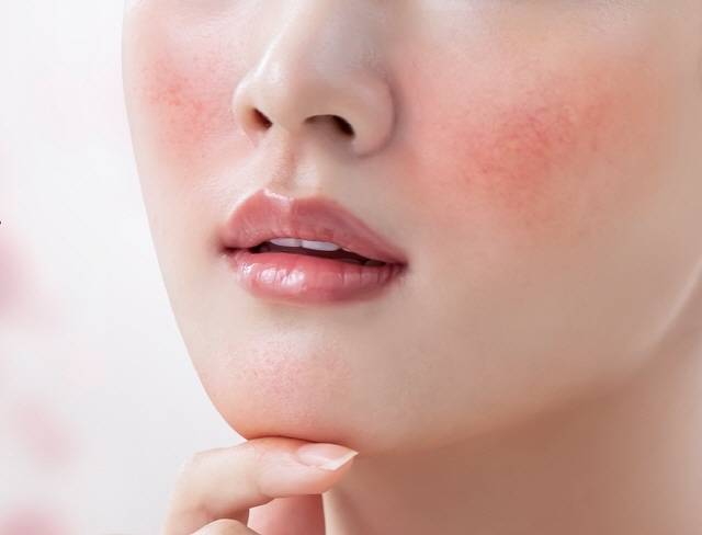 술을 한 잔만 마셔도 얼굴이 잘 빨개지는 이유는 체내 알세하이드 탈수소효소(ALDH)가 적기 때문이다. 클립아트코리아