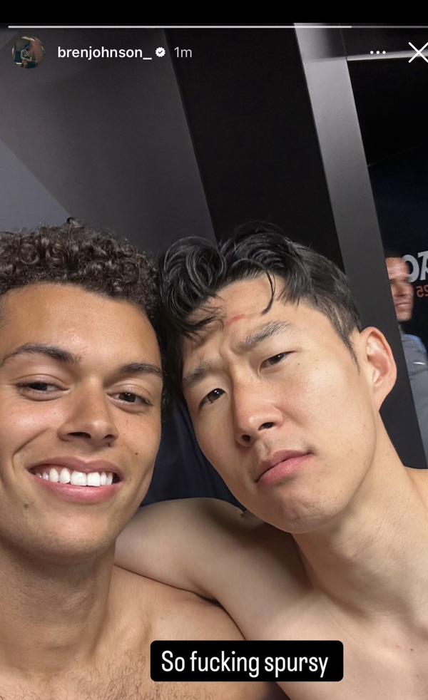 사진=존슨 SNS