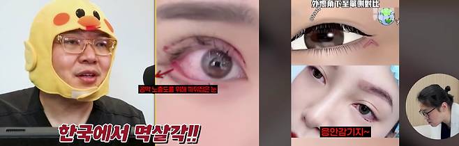 출처=에이트성형외과 유튜브, 한나이브 성형외과 유튜브
