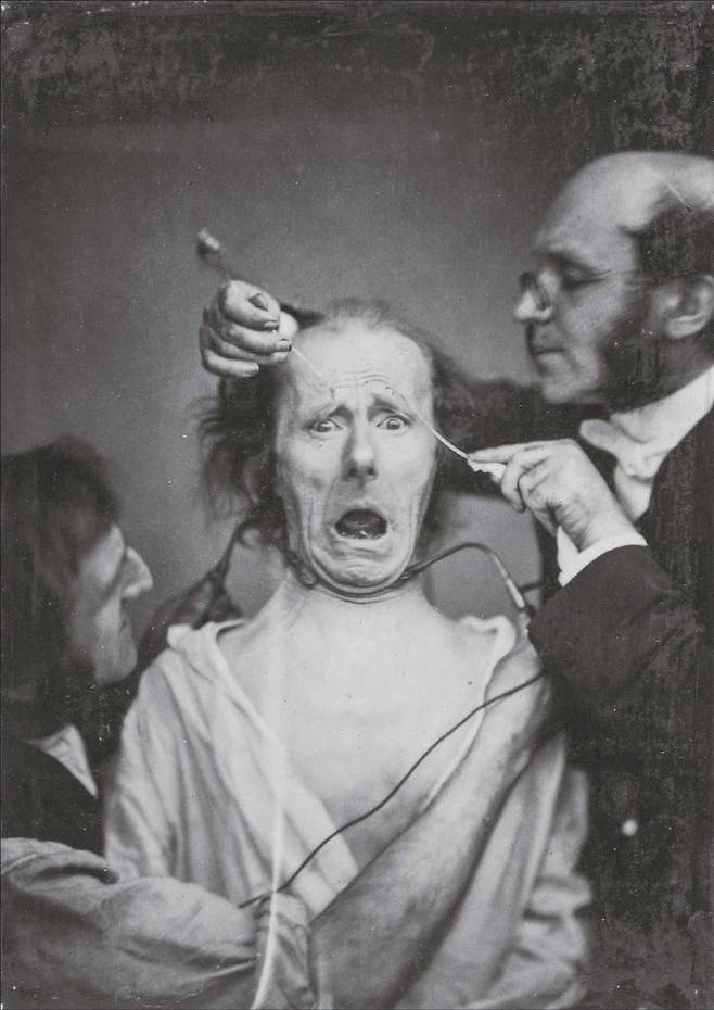 뒤센과 그의 조수가 노인의 얼굴 근육을 자극하여 표정이 만들어지는 과정을 시연하고 있다. 뒤센은 표정이 인간의 본질적 감정으로 영혼과 연관되어 있다고 믿었다. 그는 입꼬리와 눈주름으로 만들어지는 표정을 ‘진정한 행복’의 표현이라고 주장했다.