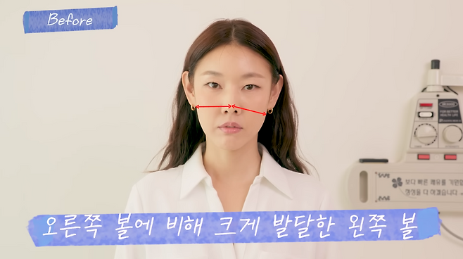 모델 한혜진이 생애&nbsp;처음 받아본 침 성형으로 20분 만에 놀라운 차이를 느꼈다.&nbsp;유튜브 채널 ‘한혜진 Han Hye Jin’ 캡처