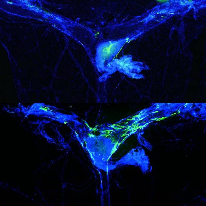 미국 워싱턴대 의대 연구팀은 뇌를 둘러싼 조직인 수막(파란색)에 있는 림프관(녹색)의 기능을 인위적으로 강화한 쥐가(아래쪽), 림프관 기능이 약한 쥐(위쪽)에 비해 기억력이 향상된 것을 확인했다. 림프관은 뇌 속 노폐물을 제거하는 역할을 한다. 김경덕 제공