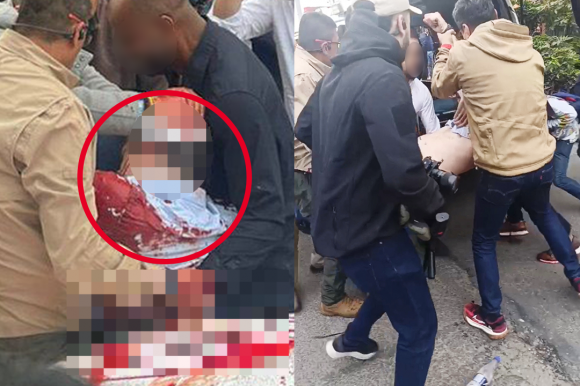 7일(현지시간) 콜롬비아 보고타에서 총격을 받은  미겔 우리베 투르바이(39) 콜롬비아 상원의원이 구급차로 옮겨지고 있다. 엑스 캡처