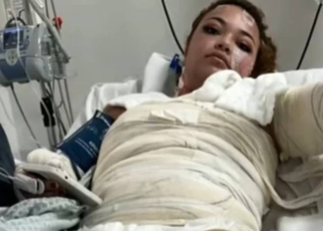 브라질의 한 모텔 방에서 온수 욕조 사고로 화상을 입은 20대 여성이 끝내 숨져 안타까움을 주고 있다. /사진=메트로폴스