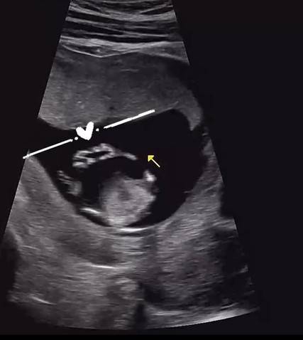 사진=박가령 공식 계정