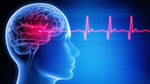 증상 없다가 갑자기 파열되는 뇌동맥류의 이명은 '머릿속 시한폭탄'이다｜출처: 게티이미지뱅크