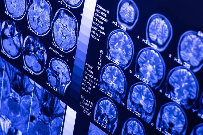 사진=게티이미지코리아.