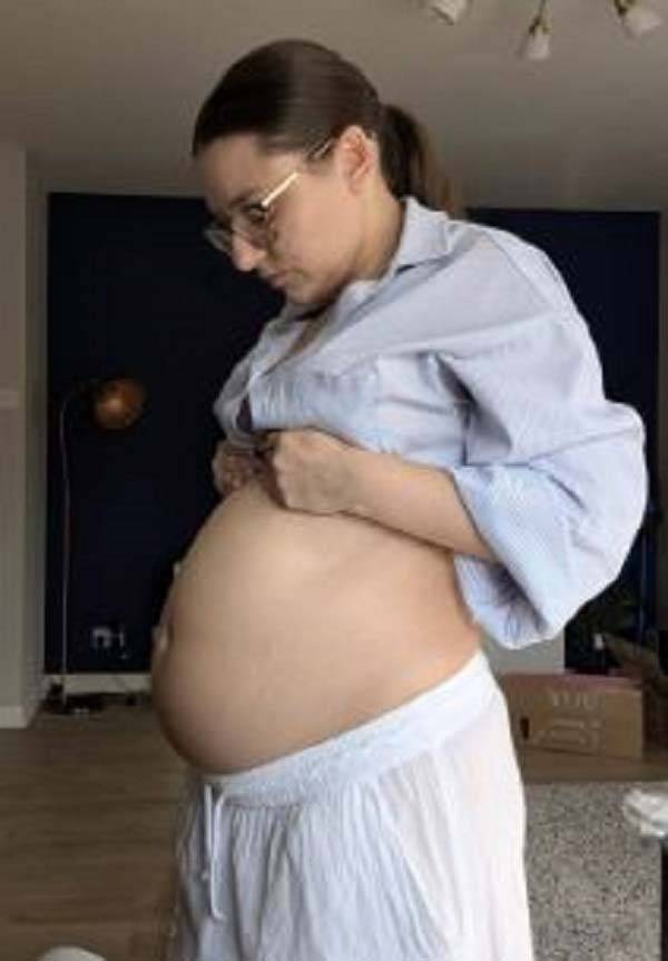 영국의 한 20대 여성이 배가 부풀어 오르는 증상을 겪고, 이후 난소낭종을 진단받았다는 사연을 공개했다./사진=더 미러