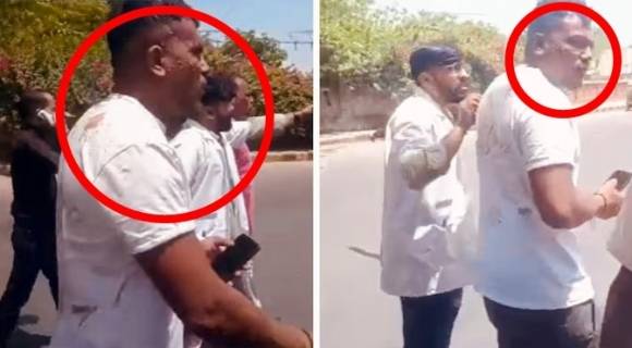 12일(현지시간) 오후 1시 39분쯤 242명을 태운 에어인디아 AI1717편 여객기가 인도 서부 구자라트주 ‘사르다르 발라브바이 파텔 국제공항’에서 이륙 직후 공항 경계선 밖 메가니나가르 주거지에 추락해 탑승자 전원이 사망한 것으로 알려진 가운데, 현지 경찰이 사고 현장에서 생존자 1명을 발견했다고 밝혔다. 인디아투데이에 따르면 경찰 관계자는 “추락한 에어인디아 항공편 승객 중 1명인 라메쉬 비슈와스쿠마르 부하르바디가 기적적으로 생존했다. 11A 좌석에서 그를 발견해 병원으로 옮겼다”라고 설명했다. 사진은 사고 현장에서 걸어나온 것으로 알려진 생존자. 2025.6.12 인디아투데이