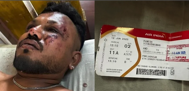 에어인디아 AI171편의 탑승자 242명 중 기적적으로 생존한 비슈와시쿠마르 라메시. 인디아투데이