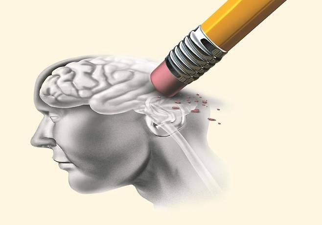 알츠하이머병 자료 이미지. /셔터스톡