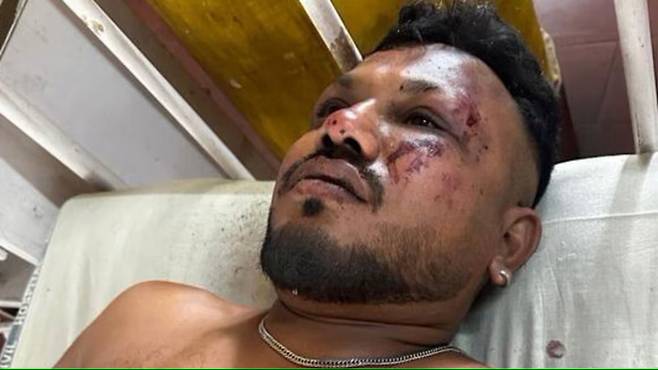 에어인디아 여객기 추락하고에서 유일한 생존자로 알려진 비슈와시 쿠마르 라메시. 한두스탄타임스 캡처