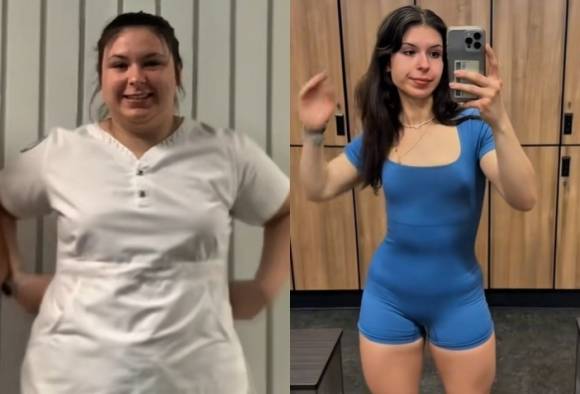 약물이나 수술 없이 식단 조절로 45㎏ 감량한 캐나다 간호사 멜라니 코즈. 멜라니 코즈 틱톡 캡처