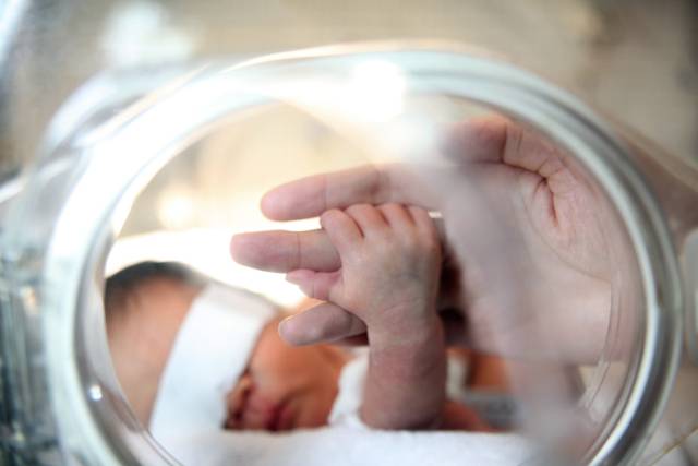 이른둥이로 태어난 아기가 신생아중환자실에서 치료를 받고 있다. 사진 제공=고대구로병원