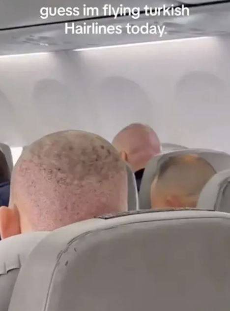 튀르키예에서 모발 이식 수술을 받은 것으로 보이는 남성들. /사진=틱톡 캡처