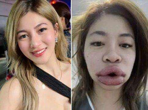 ⓒ메나루지 SNS·바스틸레포스트 갈무리