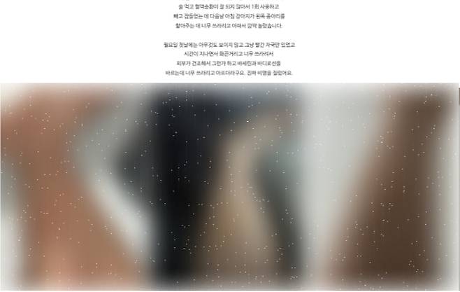 또다른 고객은 "문제의 온열 기능을 사용하지 않았음에도 저온 화상을 입었다"고 주장했다. SNS 캡처