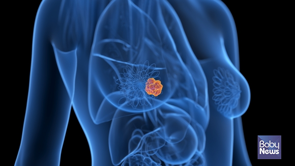 유방암은 꾸준히 증가하는 추세다. 국가암정보센터에 따르면 2022년 유방암 발생자 수는 2만 9391명으로 2017년 2만 2395명에 비해 약 30% 이상 증가했다. ⓒ베이비뉴스