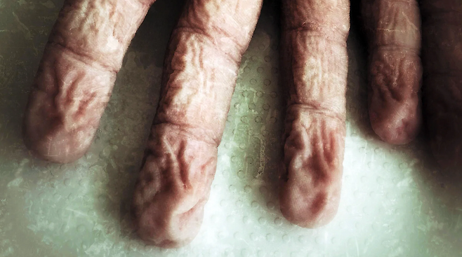 손을 따뜻한 물에 몇 분간 담그면, 손 끝에 쭈글쭈글한 자두처럼 주름이 생긴다