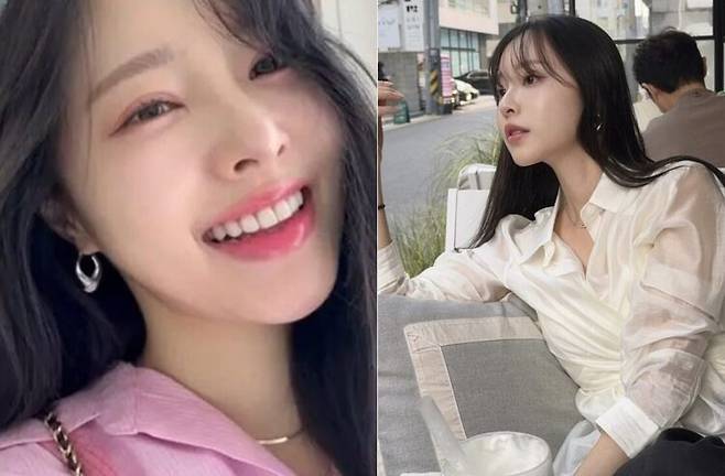 지난 4월 여성암 투병 사실을 고백했던 이솔이가 최근 한관종 치료 중인 근황을 전했다. [사진=SNS]