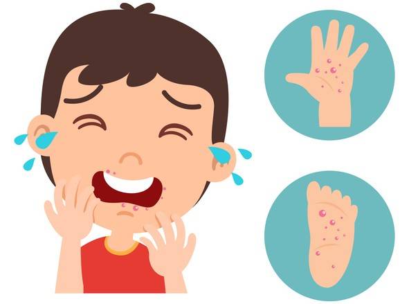 여름철 아이와 물놀이를 할 때는 수족구병에 걸리지 않도록 각별한 주의가 필요하다. 게티이미지뱅크 제공.