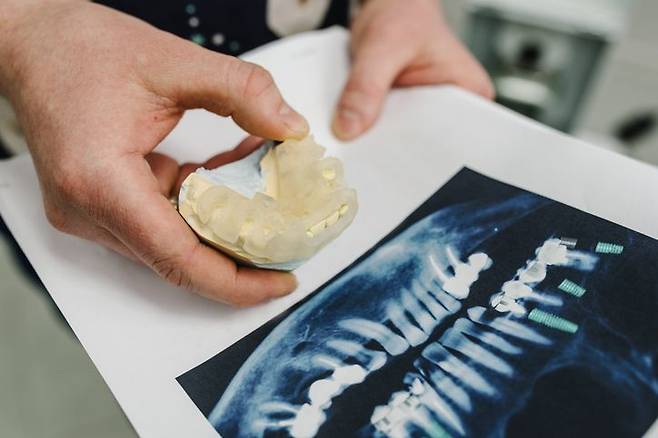 잇몸질환을 치료하는 과정에서 영구치 5개를 발치했다가 3개 치아에 대해서만 보험금을 지급받은 사례가 공개됐다. 게티이미지