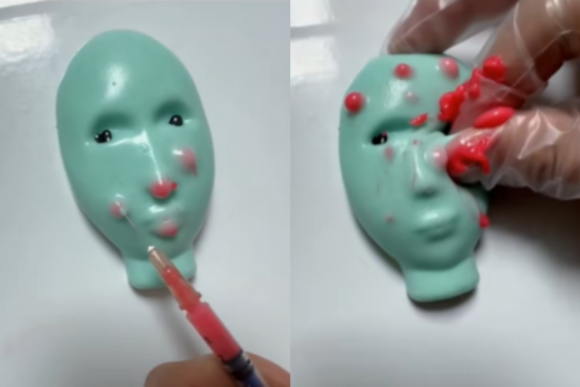 최근 어린이들 사이에서 유행 중인 ‘여드름 짜기 장난감’에 실제 주삿바늘이 포함돼 있어 안전성 논란이 일고 있다. 틱톡(@griselda.morrisona)캡처