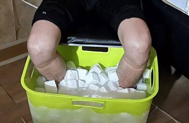 대만의 한 20대 남성이 보험금을 노리고 드라이아이스에 10시간 동안 발을 담갔다가 동상으로 두 발이 절단되고 결국 보험 사기 혐의로 기소돼 실형을 선고받았다. /홍콩 사우스차이나모닝포스트