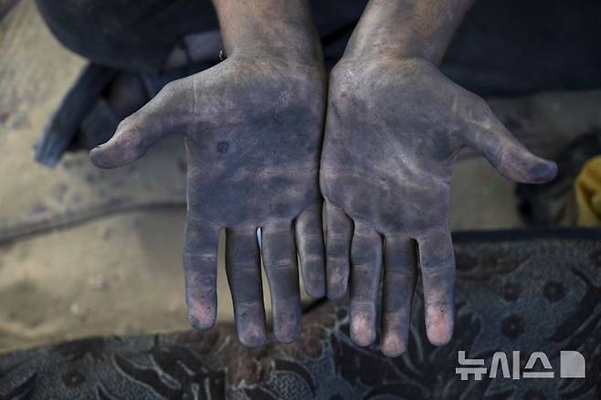 [가자시티=AP/뉴시스] 지난 22일(현지 시간) 가자지구 가자시티 남쪽 시로드에서 한 팔레스타인 남성이 플라스틱을 녹여 연료를 추출하는 작업을 하면서 본인 손을 보여주고 있다. 팔레스타인 청년들은 플라스틱 폐기물을 금속 드럼에 넣고 가열해 만든 연료를 병에 담아 판매하며, 이는 현지에서 발전기나 이동용 연료로 사용된다. 유독한 연기와 불길에 노출되는 고된 작업이지만, 이들에게는 가족의 생계를 이어가는 거의 유일한 수단이다. 2025.06.25.