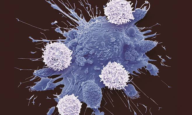 T세포(흰색)가 암세포(파란색)을 공격하는 모습의 주사 전자현미경 사진. /스티브 그슈마이스너(사이언스 포토 라이브러리)