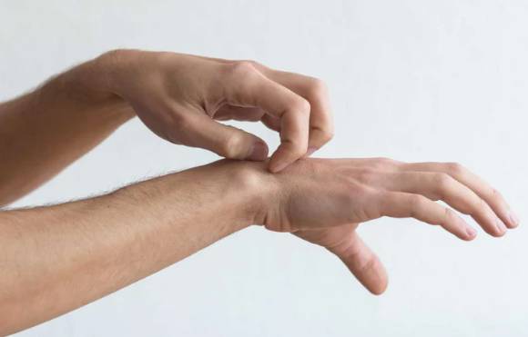 더위를 느낄 때 자주 가렵다면 '콜린성 두드러기'일 가능성이 높다. 사진은 본 기사 내용과 무관. [사진=Dermeleve®]