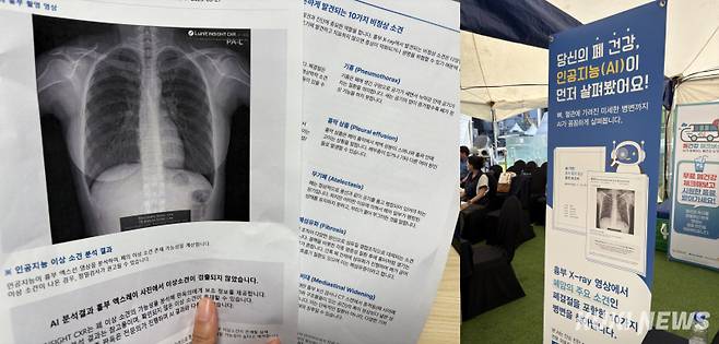 ‘폐 건강 체크버스 캠페인’은 흉부 엑스레이 촬영 후 간단한 결과지와 건강 정보가 담긴 리포트를 제공한다. 박선혜 기자