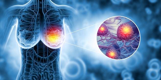 사진=게티이미지코리아.