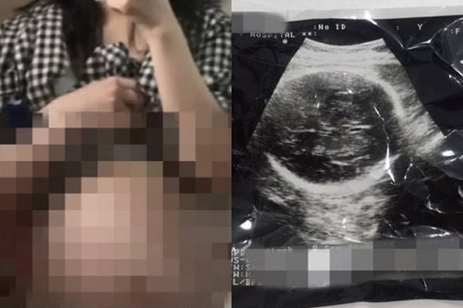 20대 여성 A씨가 유튜브에 올린 영상 캡처