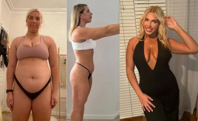 스트레스나 감정 기복이 있을 때마다 먹어 대 체중이 늘었던 한 여성이, 당뇨와 다낭성 난소 증후군 위험을 진단 받고 45kg 감량에 성공한 비결을 공유했다. [사진=SNS]