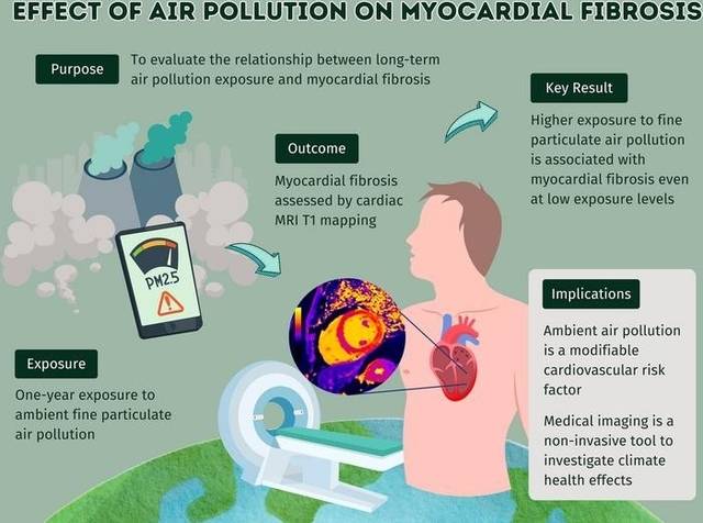 대기오염이 심근 섬유화에 미치는 영향 . Radiological Society of North America(RSNA) 제공.