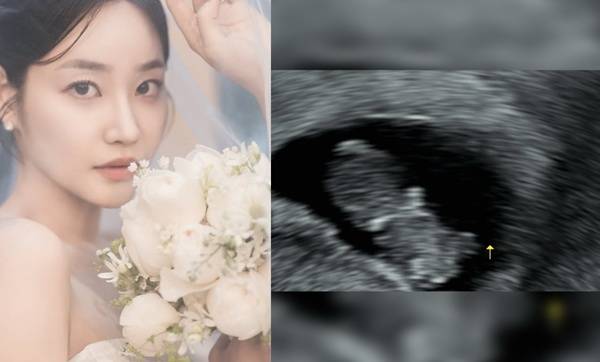 AOA 출신 유나 임신 소식 / 사진=SNS 캡처