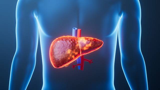 간경병증은 간이 점점 굳어가는 병으로 '간경화(肝硬化)라고도 불린다｜출처: 클립아트코리아