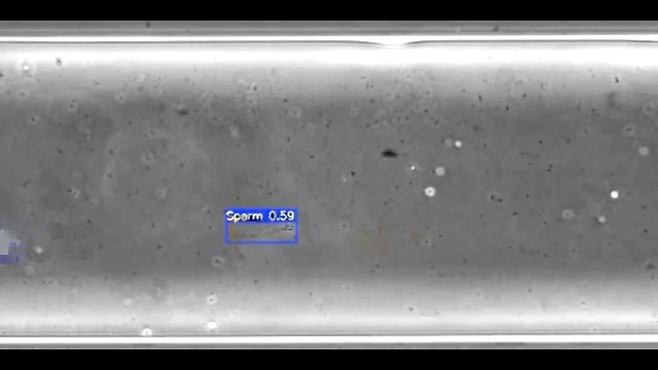 STAR 시스템을 활용한 정차 추적 과정. 사진 출처 컬럼비아대 난임센터