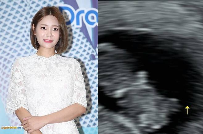 뉴스엔DB, 유나 소셜미디어