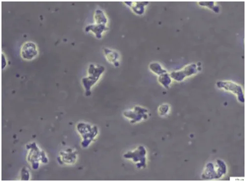 ‘뇌 먹는 아메바’  파울러자유아메바(Naegleria fowleri) [미 CDC 화면 캡쳐]