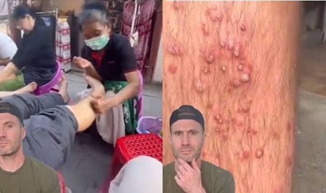 사진=조 휘팅턴 박사 소셜미디어