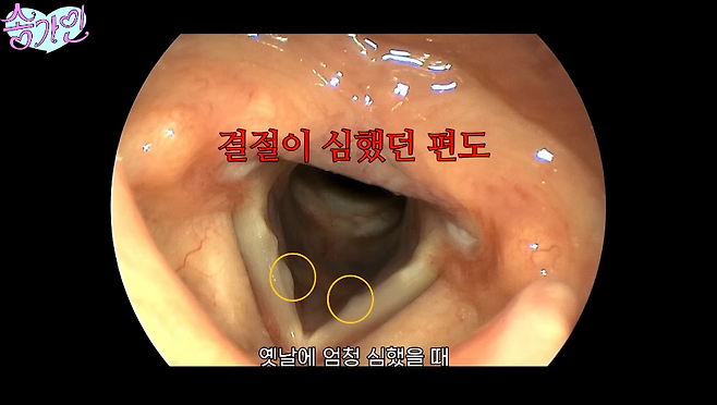 유튜브 채널 ‘송가인’