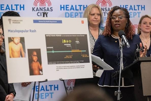 미국 캔자스시티 보건국장 마비아 존스가 지난 4월 29일 캔자스시 홍역 대책 기자회견에서 질문에 답하고 있다. [게티이미지]