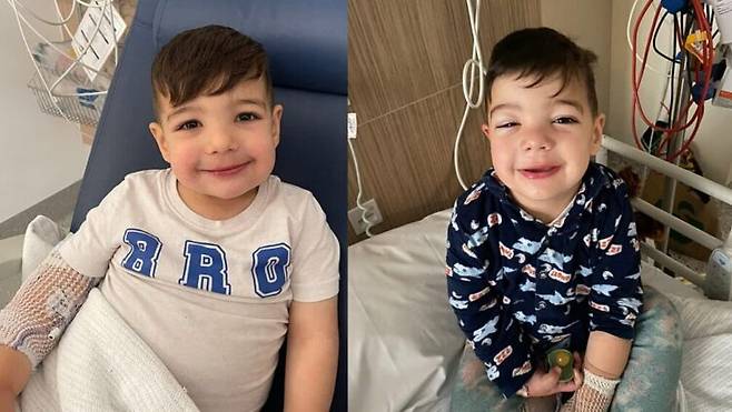 세 차례나 알레르기 진단을 받은 세 살 아이가 뒤늦게 신장질환 진단을 받은 사연이 소개됐다. [사진=SNS]